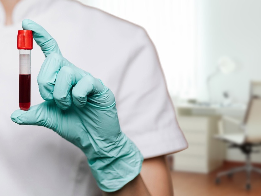 Hematologická ambulance - Oblastní nemocnice Příbram (areál I)