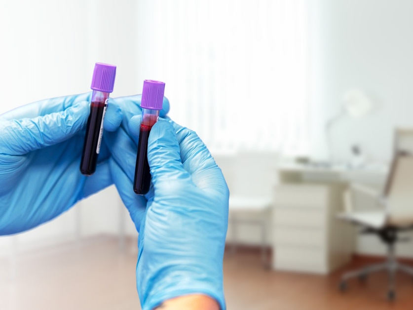 Odběrová laboratoř Oblastní nemocnice Příbram - pobočka Dobříš